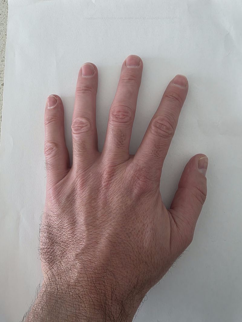 Fingernail sample 1