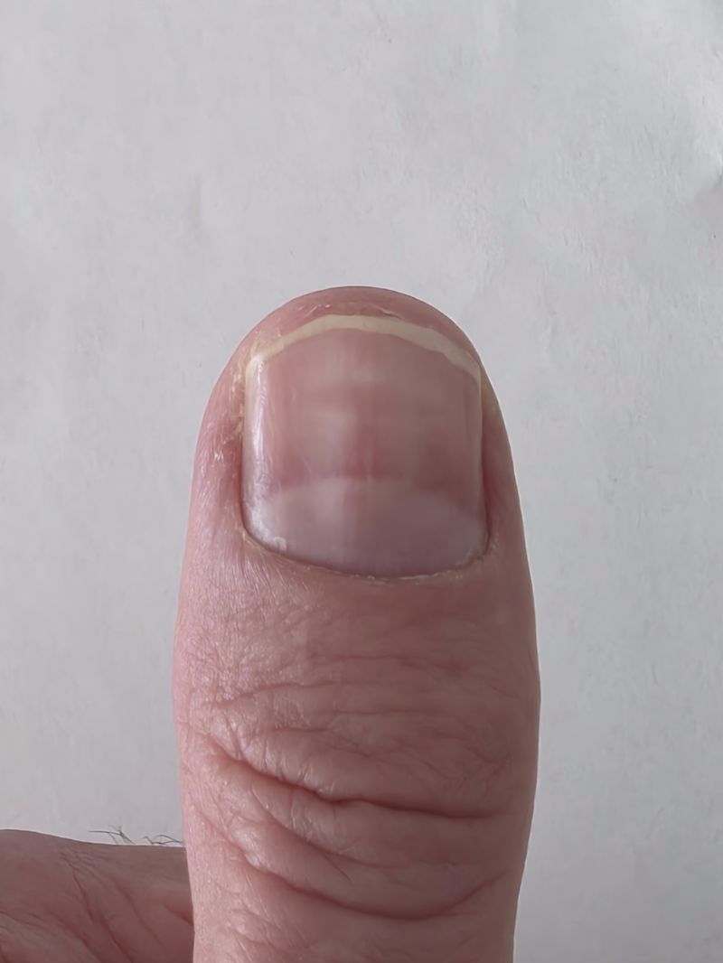 Fingernail sample 2